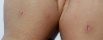 Así es 'El abecedario del diablo': el juego sádico que impone a los niños una herida por cada letra